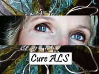 ALS Eyes for A Cure