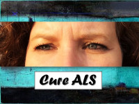 ALS Eyes for A Cure