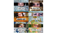 ALS Eyes for A Cure